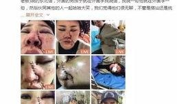 网友爆料被打脸视频播放,真相揭晓，反转剧情引热议